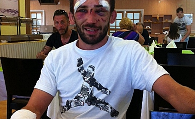 "Braveheart" Blazicevic made it to the end of the match with broken fist, nose, cheekbone…(FOTO)